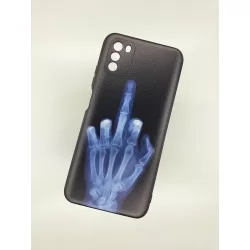 Silikonový obal na Samsung Galaxy A12 s potiskem-Rentgen