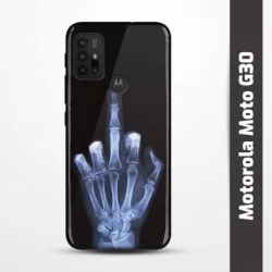 Pružný obal na Motorola Moto G30 s motivem Rentgen