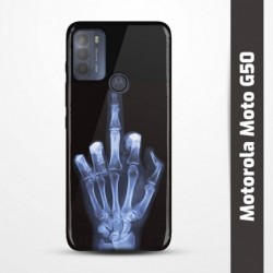 Pružný obal na Motorola Moto G50 s motivem Rentgen