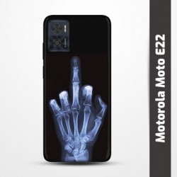 Pružný obal na Motorola Moto E22 s motivem Rentgen