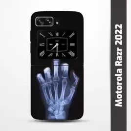 Pružný obal na Motorola Razr 2022 s motivem Rentgen