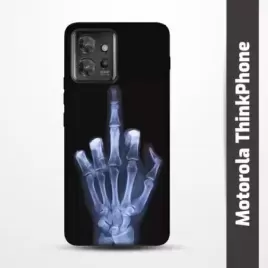 Pružný obal na Motorola ThinkPhone s motivem Rentgen